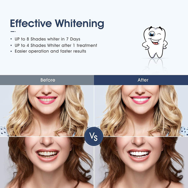MiroPure Teeth Whitening Kit with (3) 3mL Dental-grade Whitening Gel